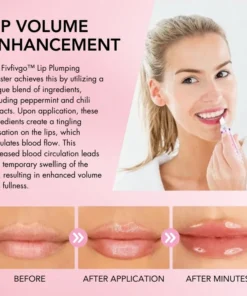 Oveallgo™ Lip Plumping Booster