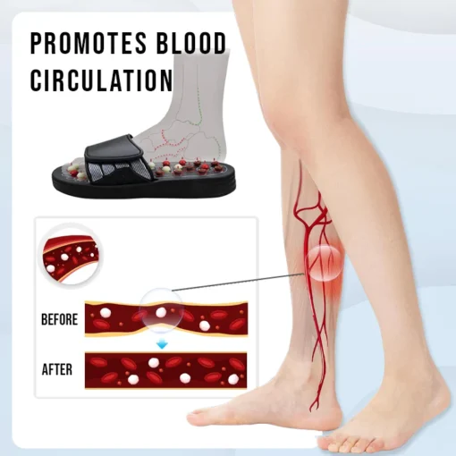 Oveallgo™ ReflexoSoothe Acupressure Sandals - Image 5