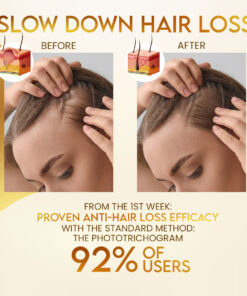 Stovis™ Biotin Premium Boost Hair Growth Spray