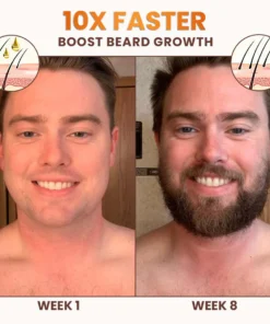 Stovis™ Premium Biotin Hair&Beard Booster