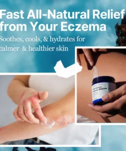 The Ocean Healed Eczema Soothing Cream