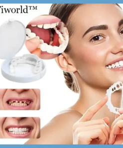 Tiworld™ Adjustable Snap-On Dentures