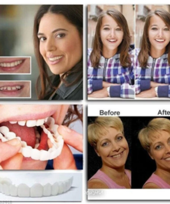 Tiworld™ Adjustable Snap-On Dentures