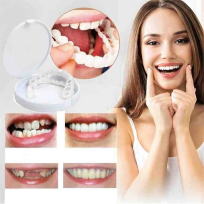 Tiworld™ Adjustable Snap-On Dentures