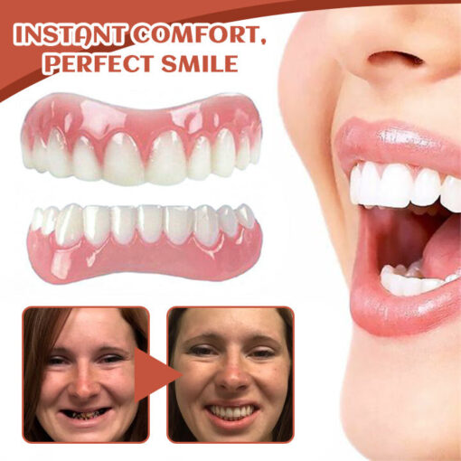 Tiworld™ PerfectFit Denture Silicone Reline Kit