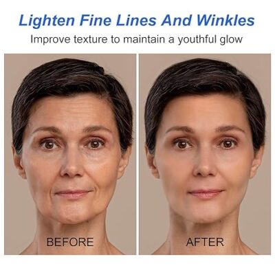 Tiworld™ Wrinkle Removal Face Cream