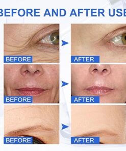 Tiworld™ Wrinkle Removal Face Cream