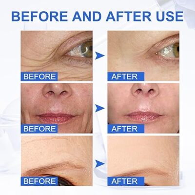 Tiworld™ Wrinkle Removal Face Cream