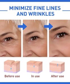 Tiworld™ Wrinkle Removal Face Cream