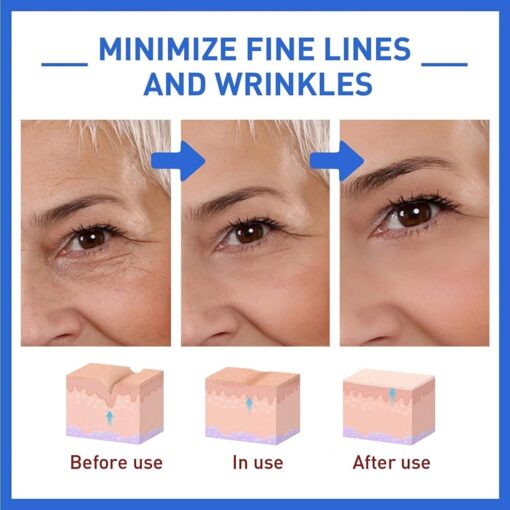 Tiworld™ Wrinkle Removal Face Cream