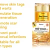 Toclve™ BEE VENOM Wart & Mole Removal Cream