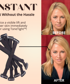 ToneTight™ Instant Facelift Strap