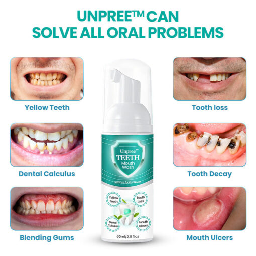 UNPREE™ Herbal Mouthwash Foam