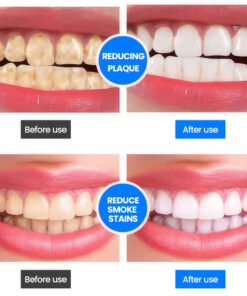 Unpree™ SP-4 Probiotic Whitening Toothpaste