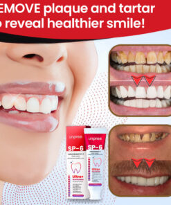 Unpree™ SP-6 Ultra+ Probiotic Whitening Toothpaste