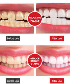 Unpree™ SP-6 Ultra+ Probiotic Whitening Toothpaste