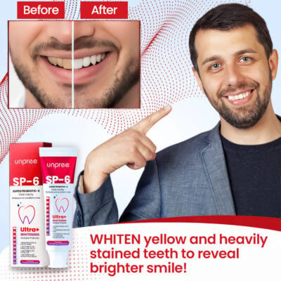 Unpree™ SP-6 Ultra+ Probiotic Whitening Toothpaste