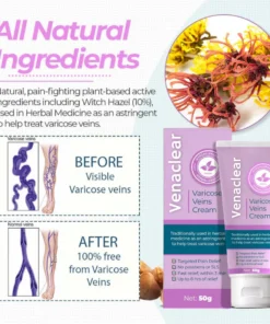 Venaclear™ Varicose Veins Cream