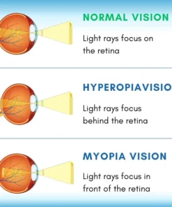 VizoClear™ Daily Liquid Lens