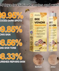 ZVLZVL™ Bee Venom Mole and Wart Treatment Spray