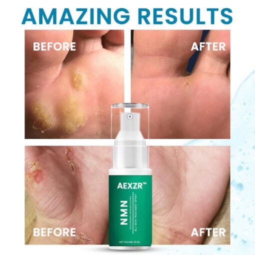 AEXZR™ NMN All-Skin Treatment Spray