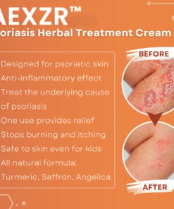 AEXZR™ Psoriasis Herbal Treatment Cream