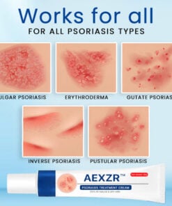 AEXZR™ Psoriasis Treatment Cream