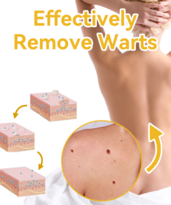 Bee Venom Wart & Moles Removal Cream