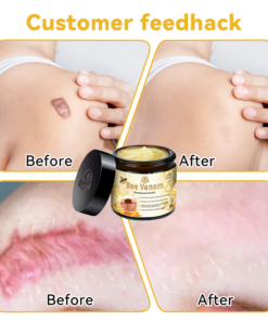 Turonu™ Bee Venom Skin Treatment Cream