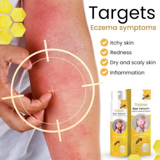 Vuitoze™ Bee Venom Eczema Treatment Spray