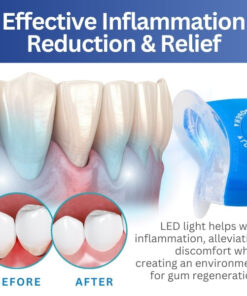 AEXZR­™ LED Light Gum Repair