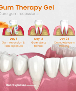 AEXZR™ Gum Repair Treatment Ampoules