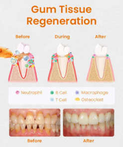 AEXZR™ Gum Repair Treatment Ampoules