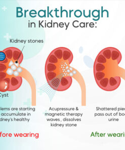 AEXZR™ Kidney Care Point Clip