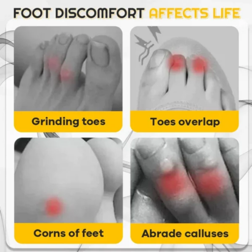 AEXZR™ Silicone Anti-Friction Toe Protector