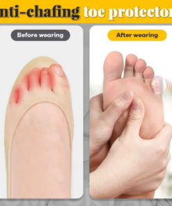 AEXZR™ Silicone Anti-Friction Toe Protector