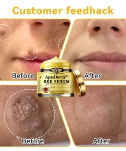 ApisDerm™ Bee Venom Skin Treatment Cream