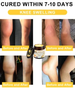 𝐒𝐩𝐳𝐯™ Bee Venom Arthritis Therapy Cream(Specially for older adults & AAOS recommends)