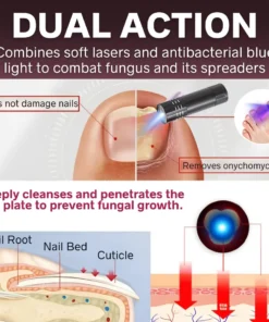 AEXZR™ Handheld Laser Nail Treatment Device