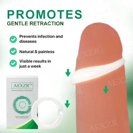 AEXZR™ Prepuce Reduction Ring