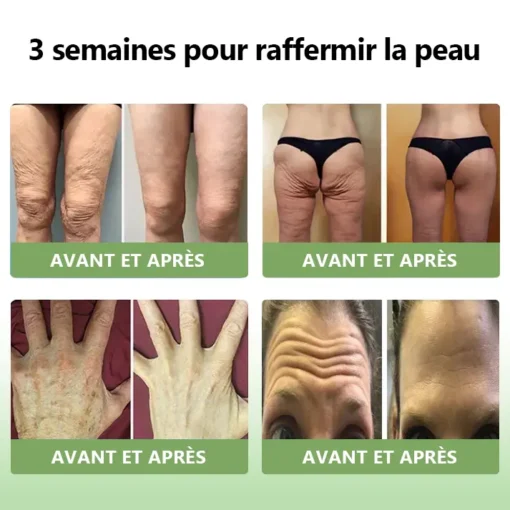 STDEI™ Crème Raffermissante au Collagène de Luxe