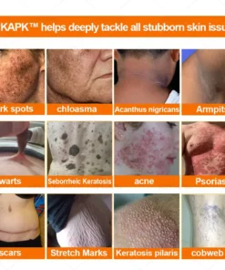 APKAPP™ Effective All-in-One Skin Treatment Cream