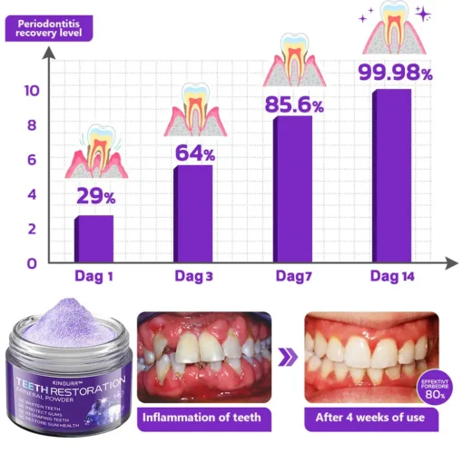 KINGURR™ TeethRestoration Mineral Powder - Image 16