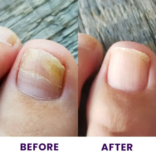 LIMETOW™ Multi-Purpose Nail Repair - Image 10