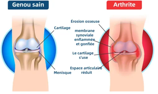 ArthroFree™ Venin D'abeille Crème - Image 39