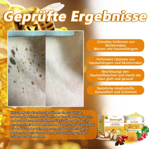 Vsoxa™ Bienengift Waren & Muttermalenfernung Creme - Image 3