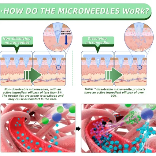 Honxi™ SMGT-GLP-1 Nano Microneedle Patch（Painless, long-lasting, addressing diabetes, obesity)