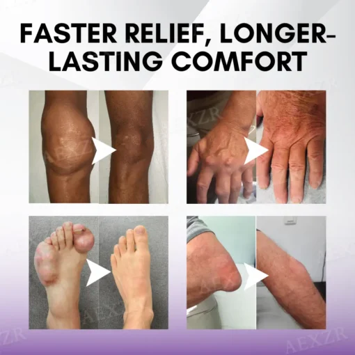TurmaCure™ Turmeric & Emu Oil Arthritis Soothing Pain Relief Massage Gel