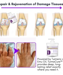 TurmaCure™ Turmeric & Emu Oil Arthritis Soothing Pain Relief Massage Gel