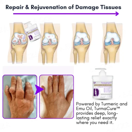 TurmaCure™ Turmeric & Emu Oil Arthritis Soothing Pain Relief Massage Gel